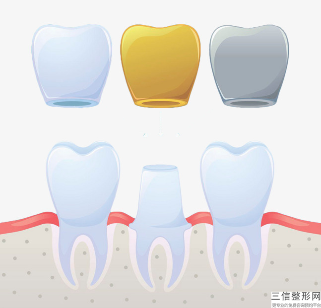 大連一般多少錢一次？洗牙的主要條件是什么？