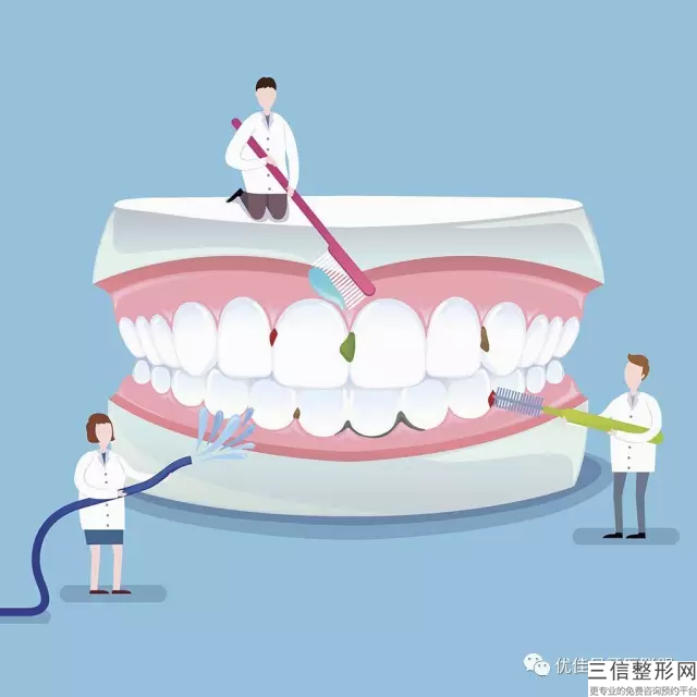 冷光美白牙齒多少錢一次受到以下因素因素的影響？