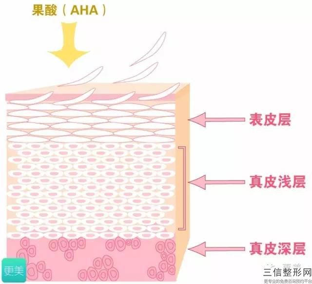 在遵義做冷光美白大概需要多少錢？遵義冷光牙齒