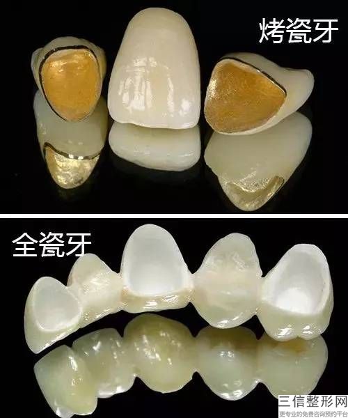 杭州牙外科正畸哪里好價格是多少