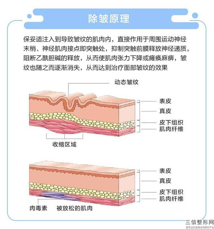 痘疤恢復(fù)正常需要多長(zhǎng)時(shí)間？去除疤痕的方法有哪些