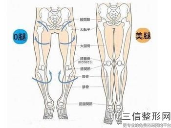 深圳抽脂的費用是多少？腹部吸脂手術(shù)費用的詳細(xì)介紹