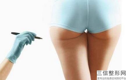 肉*素塑形多少錢,哪些人適合做肉*素注射術(shù)小腿塑形？