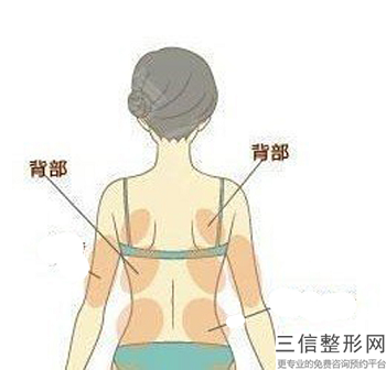 水動力吸脂瘦大腿多少錢,廣州水動力吸脂瘦大腿多少錢？