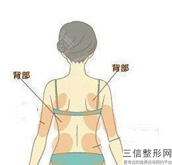 自體脂肪填充淚溝多少錢,做自體脂肪填充淚溝價(jià)格要多少