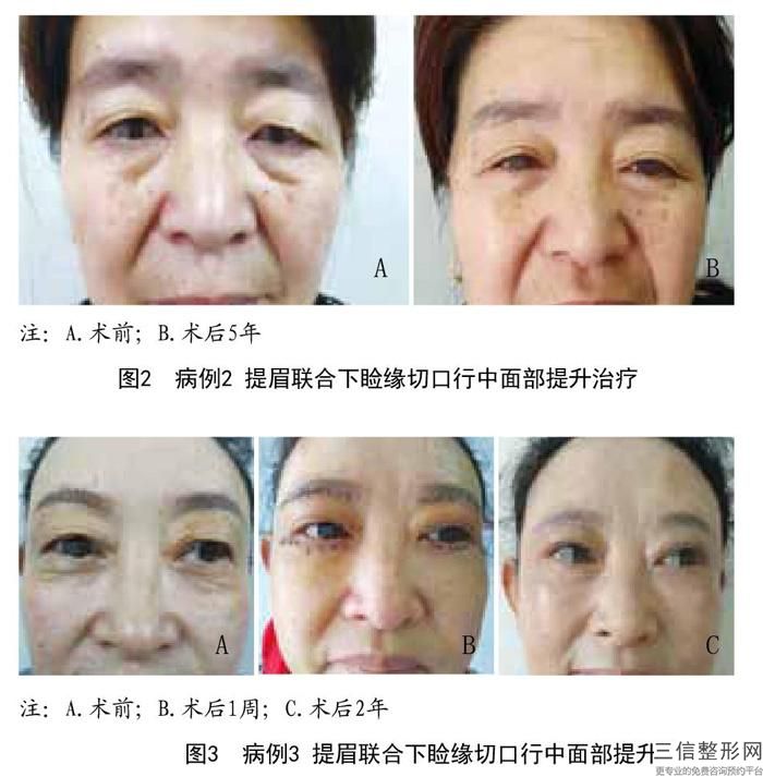感情是帆，認知是船，雙眼皮手術是人生的變遷