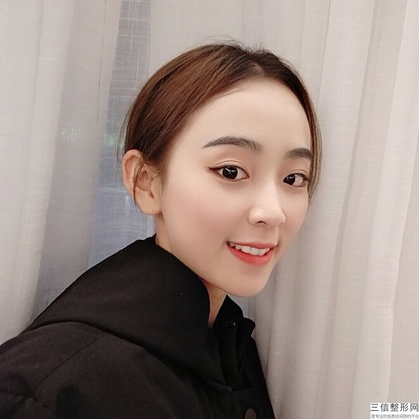 告訴你生子后除去斑點效用比較棒？