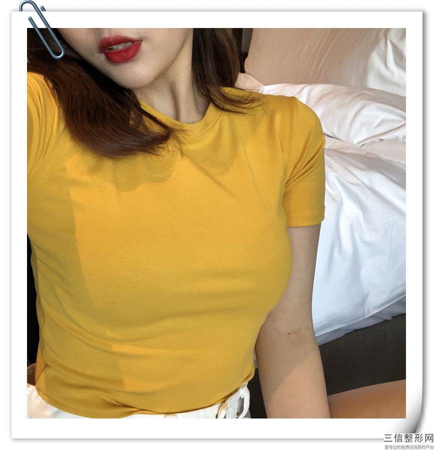 妙桃假體隆胸的價格與效果有關嗎