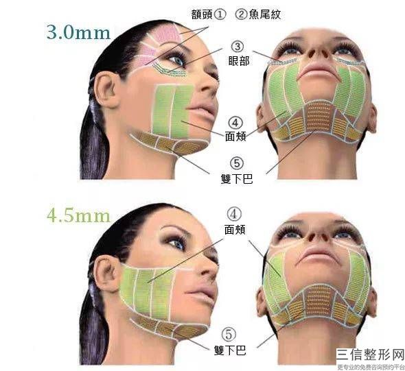 顴骨磨骨防備產生危害得做哪些方面術前準備工作