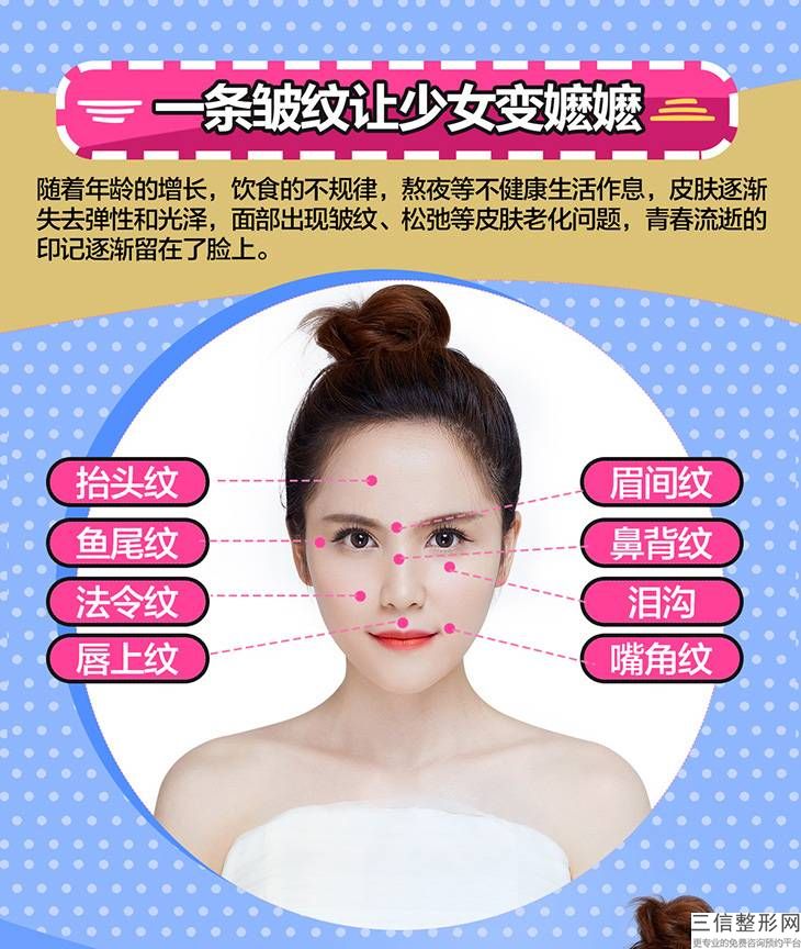 消除皺紋挑選電波拉皮去皺術(shù)價格高不高