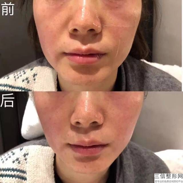 西安小白兔口腔（口腔正畸中心）怎么樣(口腔醫院地址及項目介紹)