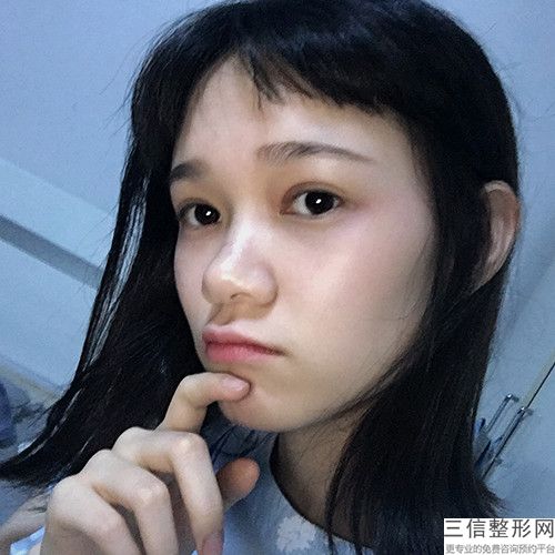 北京雙眼皮整形醫院排行榜！北京凱潤婷醫療美容醫院有限公司口碑良好