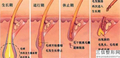 德陽市光子脫腋毛十大排行榜（德陽市光子脫腋毛整形醫(yī)院）