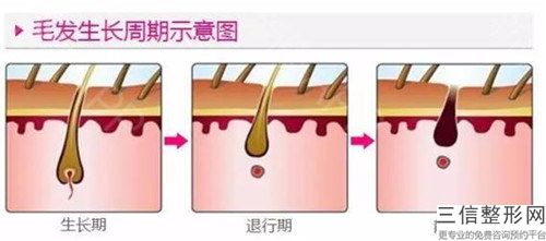 2023年雞西市激光脫手毛哪家手術效果好(雞西市激光脫手毛整形醫院)