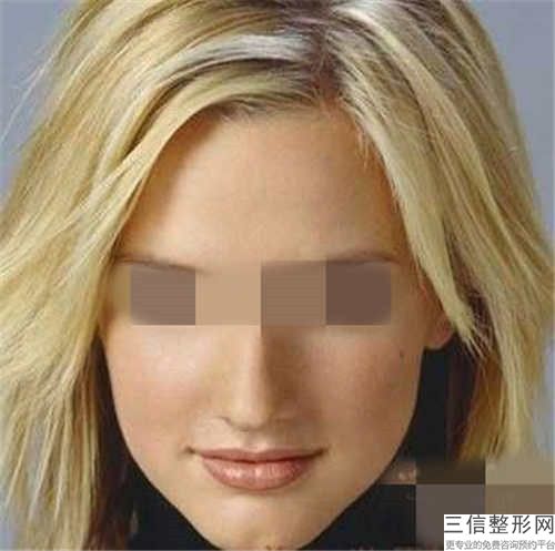 周口市唇腭裂整形美容整形外科價格表瀏覽(2023年3月均價為：7841元）