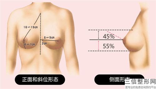 泰州市乳房縮小術醫院排名top10強榜單更新-排名靠前泰州市整形醫院