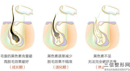 2023年盤錦市激光脫腿毛價格收費明細一覽（盤錦市激光脫腿毛具體價格是多少呢）