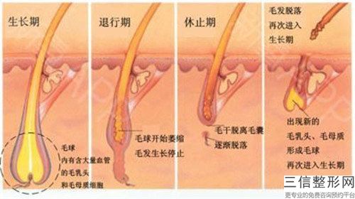 廣元市中年人頭發種植價格(目)表新版收費一覽-廣元市中年人頭發種植手術方法及費用