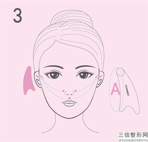六安市botox保妥適除皺醫(yī)生排名榜實力對抗-張洪波醫(yī)生點(diǎn)名率高