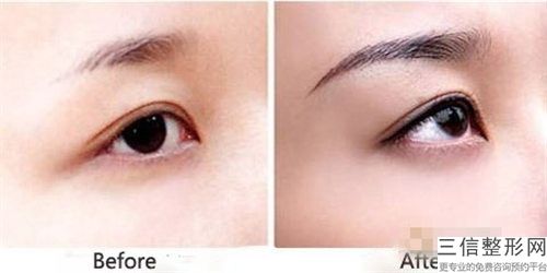 福建省眉位正修復醫(yī)院排行榜前十佳排名公布-福建省眉位正修復整形醫(yī)院