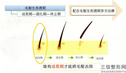 全國做植發(fā)手術(shù)醫(yī)院推薦：做植發(fā)手術(shù)醫(yī)院top50名單敲定