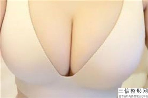 衡水垂乳上提術矯正術的價格和優點有哪些