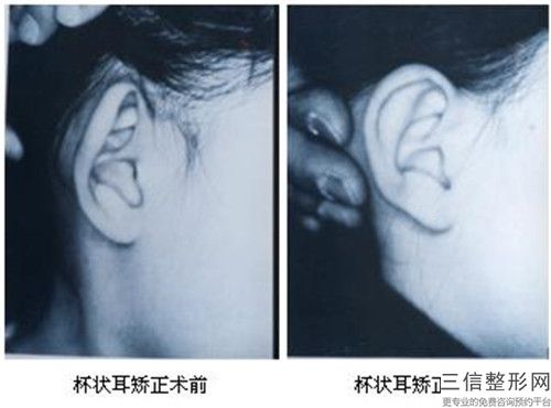 全青島市好的耳朵缺損醫(yī)院(青島新采韻醫(yī)療美容診所綜合性更強(qiáng))