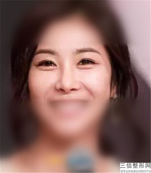 中國做光子美容整形醫院推薦：做光子美容醫院前50位給你挑選