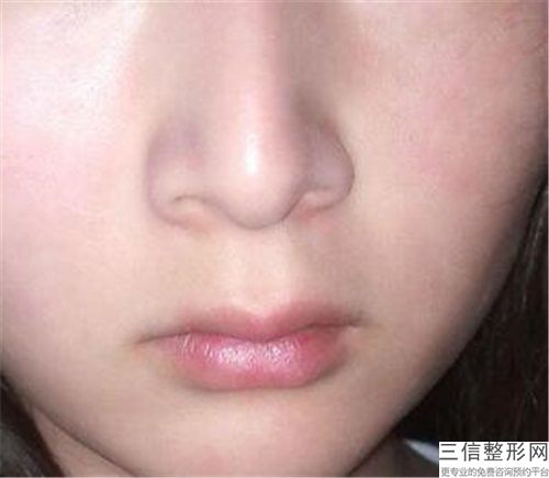 聊城市鼻子變歪矯正醫(yī)生排名榜大熱門(mén)啊-陸詩(shī)林醫(yī)生專(zhuān)家大咖云集