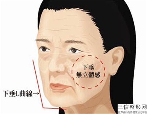 岳陽市醫院臉上雀斑除掉哪家實力好-臉上雀斑除掉價格需多少