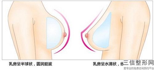 南陽水滴形假體隆胸手術失敗修復禁忌人群