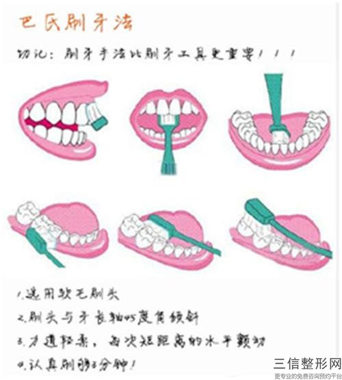 深圳博愛整形美容醫(yī)院牙列不齊矯治整形手術的效果到底怎么樣