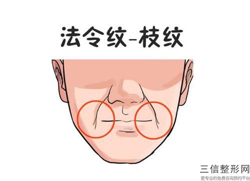 面部去皺紋手術醫生推薦中國：面部去皺紋手術醫生top50已定