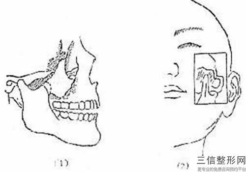 合肥華美醫(yī)療整形美容醫(yī)院削骨下顎角醫(yī)生介紹