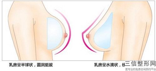 張秦鵬乳頭過(guò)矯正手術(shù)整形手術(shù)的效果有哪些因素影響