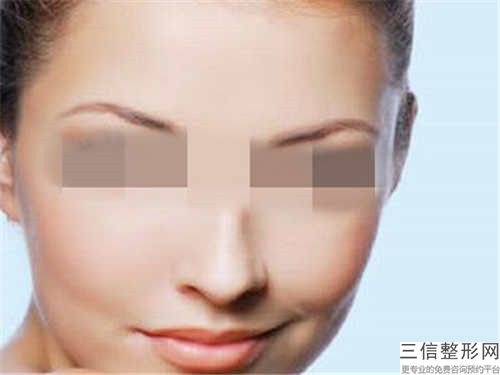 福州臺(tái)江中醫(yī)院唇裂的整形的持久性怎么樣