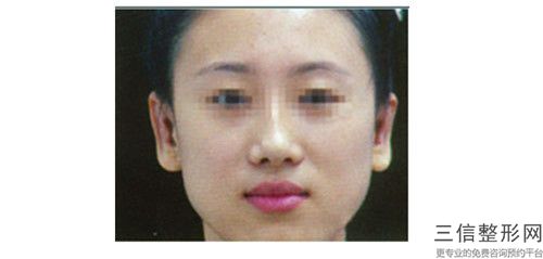 全國(guó)精靈耳怎么整形醫(yī)院推薦：精靈耳怎么整形醫(yī)院50強(qiáng)震撼發(fā)布