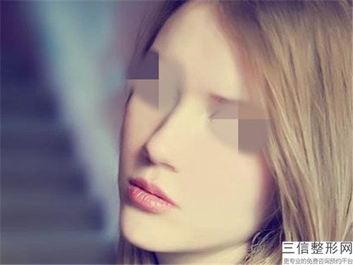 全國鼻尖美容整形有名醫生有哪些呢：鼻尖美容整形醫生top50強重點推薦