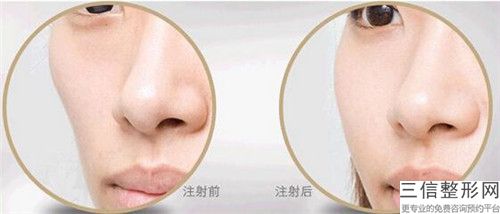 寧波徐茂口腔門診部男士臉部脫毛的術后護理是怎么做的