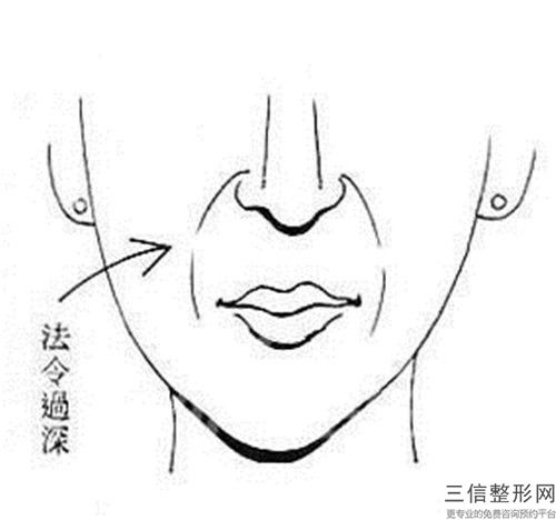 余涵韓式除皺術會對胎兒有影響嗎