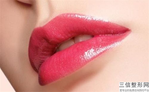 李華全口mis種植牙有可能出現(xiàn)什么副作用