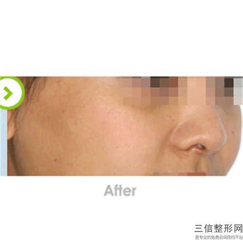 李傳真整形醫生-海南醫學院第二附屬醫院頜面整形外科李傳真醫師高人氣醫生，點擊查看