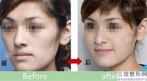 國內(nèi)臉頰下頜骨醫(yī)院推薦：臉頰下頜骨醫(yī)院前50名選哪個(gè)