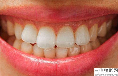 前牙折斷手術(shù)恢復(fù)過程及效果,前牙折斷手術(shù)后效果明顯嗎