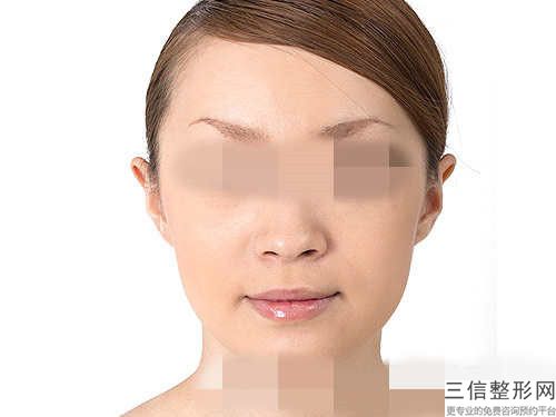 鎮江兔唇能修復怎樣做效果好