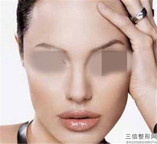 通遼畸形鼻尖的優(yōu)點及適合人群