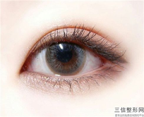 割雙眼皮干眼癥后果會怎么樣「割雙眼皮干眼癥會不會對眼睛有傷害」