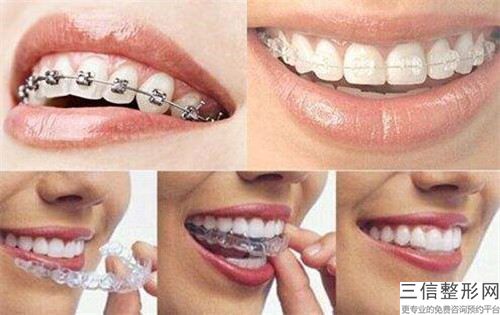 鈷鉻合金鑲牙手術存在的后遺癥風險您了解嗎