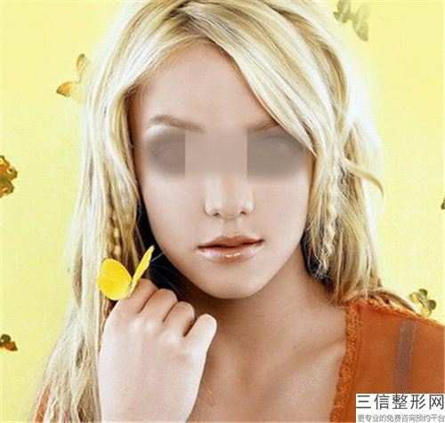 韶關(guān)注射玻尿酸墊下巴價(jià)格便宜嗎