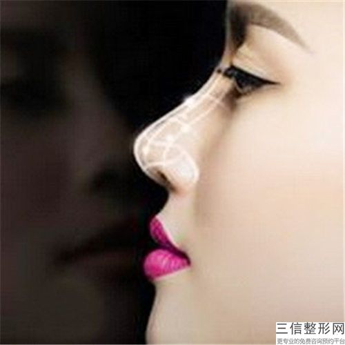 榆林皮膚磨削治療酒糟鼻的手術(shù)優(yōu)勢(shì)及人群